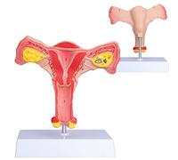 ANNWAN Female Ovary Model - Life Size Human Uterus and Ovary Model Female Reproductive Organ Model for Studying and Communication