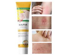 Anti-Itch Cream, 20g Biting Soothing Cream, Non-Greasy Itch Relief Ointment for Dry Combination Oily Skin Camping Travel Outdoor Post-Workout Salon Home