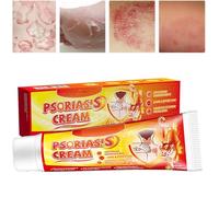 Anti-Itch & Soothing Skin Cream - Fast Relief for Irritation, Gentle on Sensitive Skin, Helps with Fungal Issues Like Ringworm, 60g Tube (A-1)