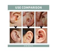 Anti Tinnitus Earwax Removal Spray Ear Wax Remover Cleaner For Tinnitus Relief