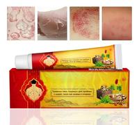 Antifungal Cream,Cream for Itchy Skin,Antifungal Cream for Skin,Itchy Skin Relief for Adults,Moisturizing Antifungal Body Cream,Anti Itching Cream for Skin,Effective Anti Fungal Skin Cream