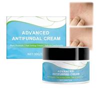 Antifungal Cream,Effective Antifungal Herbal Skin Cream,Anti Itch Cream,Fast Relief for Athlete's Foot Cream,Cr/eam for Itchy Skin,Moisturizing and Smoothing Body Cre/am,Relieve Itching Crea/m