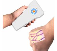 ANXYYDS Infrared Vein Finder Viewer Portable Medical Vein Locator Detector, Illumination Visualization Lights for Nurses in Transilluminator, IV Phlebotomy Venipuncture Support