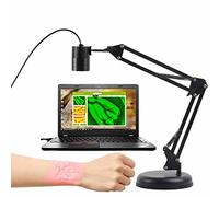 ANXYYDS Vein Finder Viewer, Portable Transilluminator Vein Locator Detector, Illumination Visualization Lights for Nurses