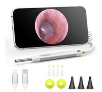 AnyScope HD Digital Otoscope, Video Ear Scope Otoscope with Light, Ultra Clear View Ear Camera with Ear Wax Removal Tools, Compatible with iPhone and Android Devices (Silver)