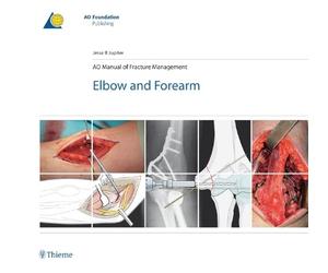 AO Manual of Fracture Management - Elbow & Forearm - 9783131492715