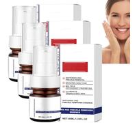 Aobenz Serum, Aobenz Spot Remover Serum, Aobenz Whitening and Freckle Removing Essence, Hydrating and Moisturizing, Gentle Dark Spot Remover, Face Serum for Women (3pcs)