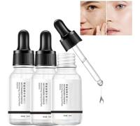 Aobenz Spot Remover for Face, Dark Spot Remover,Palespots and Freckle Removing Essence,Spot Remover Serum,Dark Spot Corrector for Face and Body,Spot Corrector Facial Serum for All Skin Types (3 Pcs)