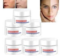 Aobenz Whitening and Freckle Removing Essence, Aobenz Cream, Aobenz Spot Remover Cream, Dark Spot Correcting Cream, Spot Remover for Face, Brightening and Removing Freckles (6pcs)