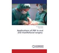 Applications of PRF in oral and maxillofacial surgery
