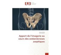 Apport de l'imagerie au cours des ostéonécroses aseptiques
