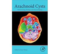 Arachnoid Cysts: Epidemiology, Biology, and Neuroimaging