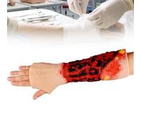 Arm Burn Wound Model, Wearable Burn Wound Model, Realistic Hand & Arm Sleeve Burn Simulator for Nursing Training, First Aid Moulage