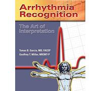 Arrhythmias: The Art of Interpretation