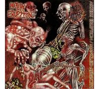 ARTERY ERUPTION / MANGLED ATROCITY - ARTERY ERUPTION / MANGLED ATROCITY - split