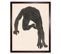 Artery8 Stolk Anatomical Study Neck Arm Leg Muscles Man Art Print Framed Poster Wall Decor 12x16 inch