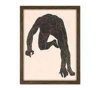 Artery8 Stolk Anatomical Study Neck Arm Leg Muscles Man Artwork Framed Wall Art Print 18X24 Inch