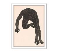 Artery8 Stolk Anatomical Study Neck Arm Leg Muscles Man Artwork Framed Wall Art Print 18X24 Inch