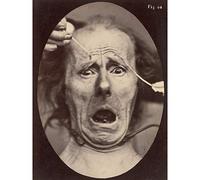 Artery8 Tournachon Electro Physiology Facial Expressions 1862 Photo Premium Wall Art Canvas Print 18X24 Inch