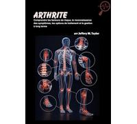 Arthrite: Comprendre les facteurs de risque, la reconnaissance des symptômes, les options de traitement et la gestion à long terme