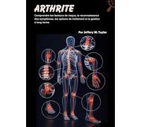 Arthrite: Comprendre les facteurs de risque, la reconnaissance des symptômes, les options de traitement et la gestion à long terme