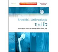 Arthritis and Arthroplasty: The Hip: Expert Consult - Online, Print and DVD
