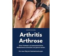 Arthritis - Arthrose. Ohne Prothesen und lebensbedrohliche Medikamente schmerzfrei und gesund werden. Der neue Weg bei Gelenkerkrankungen: Was hilft konkret bei Arthritis und/oder Arthrose?