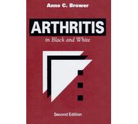 Arthritis in Black and White