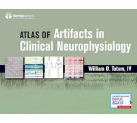 Artifacts in Clinical Neurophysiology