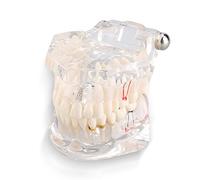 Artillery Tooth Model, Dental Disease Teaching Study Of Adult Demonstration Teeth Model, Practice And Learning Dental Disease Teaching Model