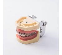 (As show, One size) Dental Calculus Model Dental Periodontal Disease Model Teeth Neural Repair Dental Implant Pathological Fitting Head Model