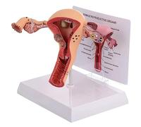 ASSICON Female Reproductive System Human Uterus Model 3d Uterus Ovary Model, Female Reproductive System, for Teaching Learning, Display Tool Uterus Anatomical Model