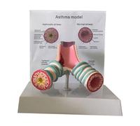Asthma Anatomy Model - Respiratory System Bronchial Model for Student Study and Teaching Display