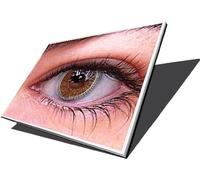 NEW Compatible Replacement MEDION AKOYA MD97860 17.3" LAPTOP SCREEN UK Dispatch