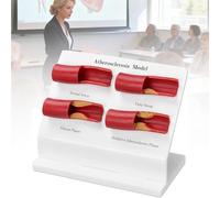 Atherosclerosis Artery Model, 4-Stage Blood Vessel Plaque Comparison Model for Medical Teaching, Cardiovascular Education Display for Classroom Clinic Training Demonstration Tool
