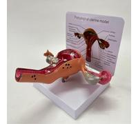 ATJOGWIN Uterus Anatomical Model Pathological Ovarian Model with Detachable Base and English Instruction Card