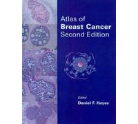 Atlas of Breast Cancer
