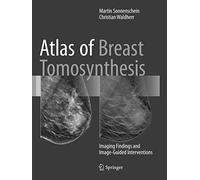 Atlas of Breast Tomosynthesis: Imaging Findings and Image-Guided Interventions