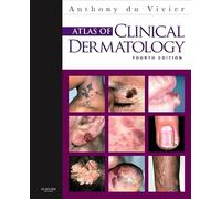 Atlas of Clinical Dermatology