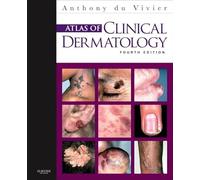 Atlas of Clinical Dermatology