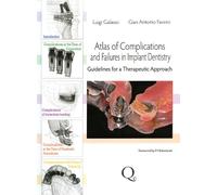 Atlas of Complications and Failures in Implant Dentistry: Guidelines for a Therapeutic Approach