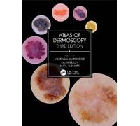 Atlas of Dermoscopy, Ashfaq A Marghoob, Hardback