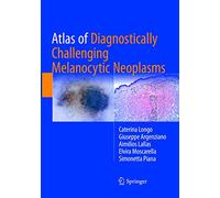 Atlas of Diagnostically Challenging Melanocytic Neoplasms