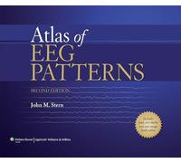 Atlas of EEG Patterns
