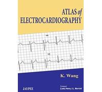 Atlas of Electrocardiography