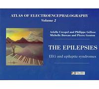 Atlas of Electroencephalography: The Epilepsies -- EEG and Epileptic Syndromes: Epilepsies - EEG and Epileptic Syndromes v. 2: Volume 2: The Epilepsies -- EEG & Epileptic Syndromes