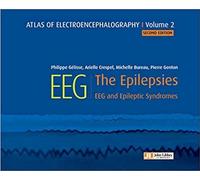 Atlas of Electroencephalography -- Volume 2: The Epilepsies, EEG and Epileptic Syndromes