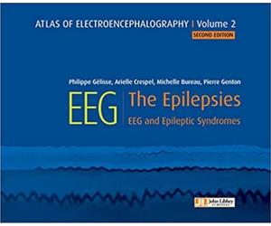 Atlas of Electroencephalography -- Volume 2: The Epilepsies, EEG and Epileptic Syndromes