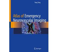 Atlas of Emergency Neurovascular Imaging