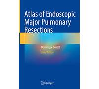 Atlas of Endoscopic Major Pulmonary Resections
